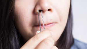 Thói quen nhổ lông mũi cũng làm tăng nguy cơ nổi mụn trong mũi